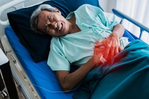 Hepatites Hepatites
