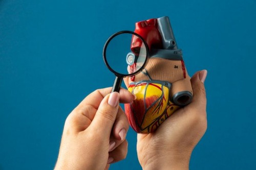 Infarto